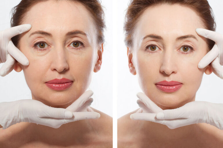 Facial Implant Surgery Price in Pakistan