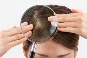 Oil Production in the scalp
