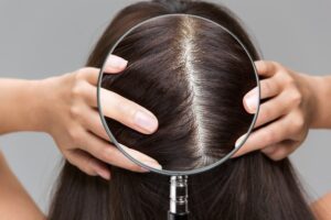 scalp pores