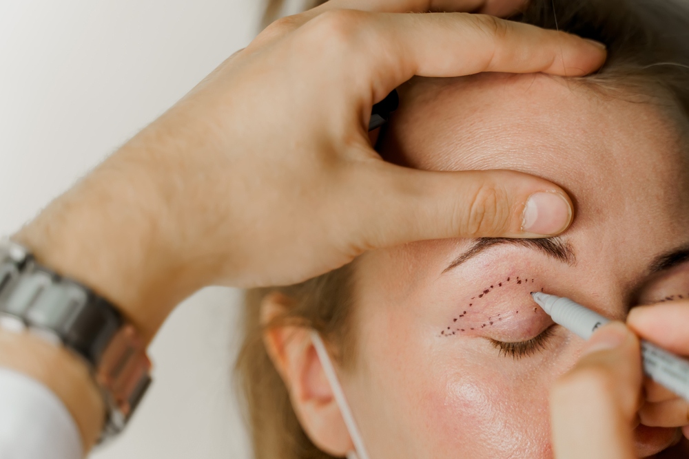 eye lid