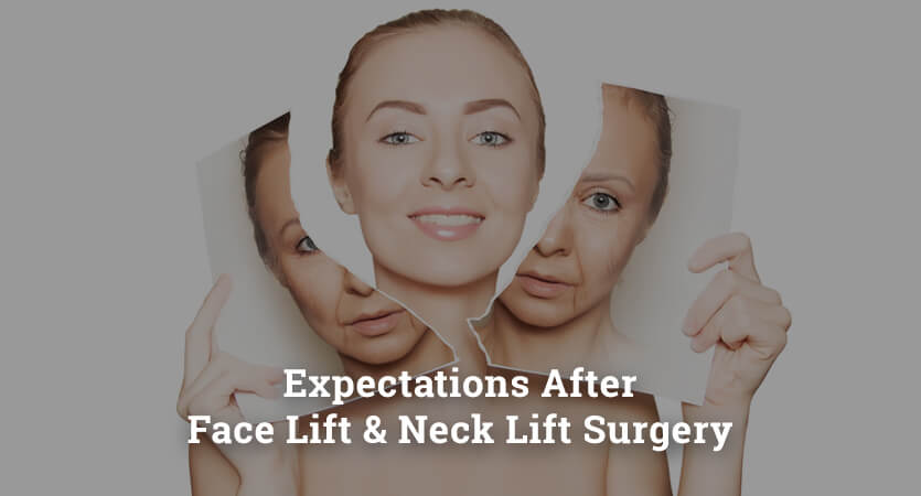 Expectations After Face Lift and Neck Lift Surgery