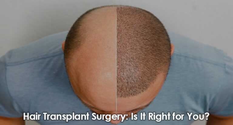 Hair Transplant Surgery Is It Right for You