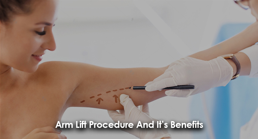 Arm Lift Procedure