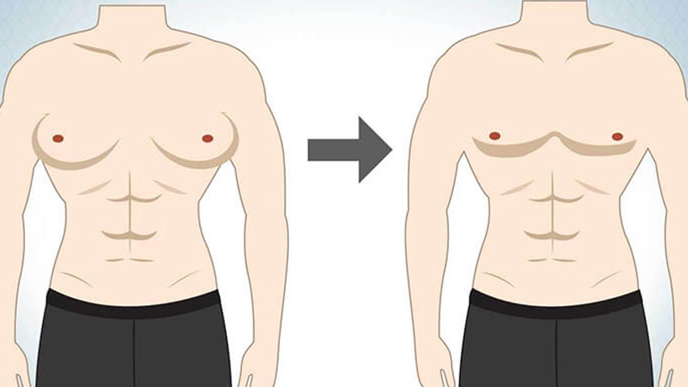 Physical Changes