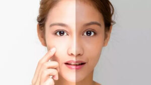 Skin Whitening Solutions for Radiant and Even-Toned Skin