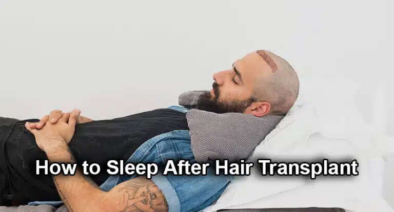 How to Sleep After Hair Transplant