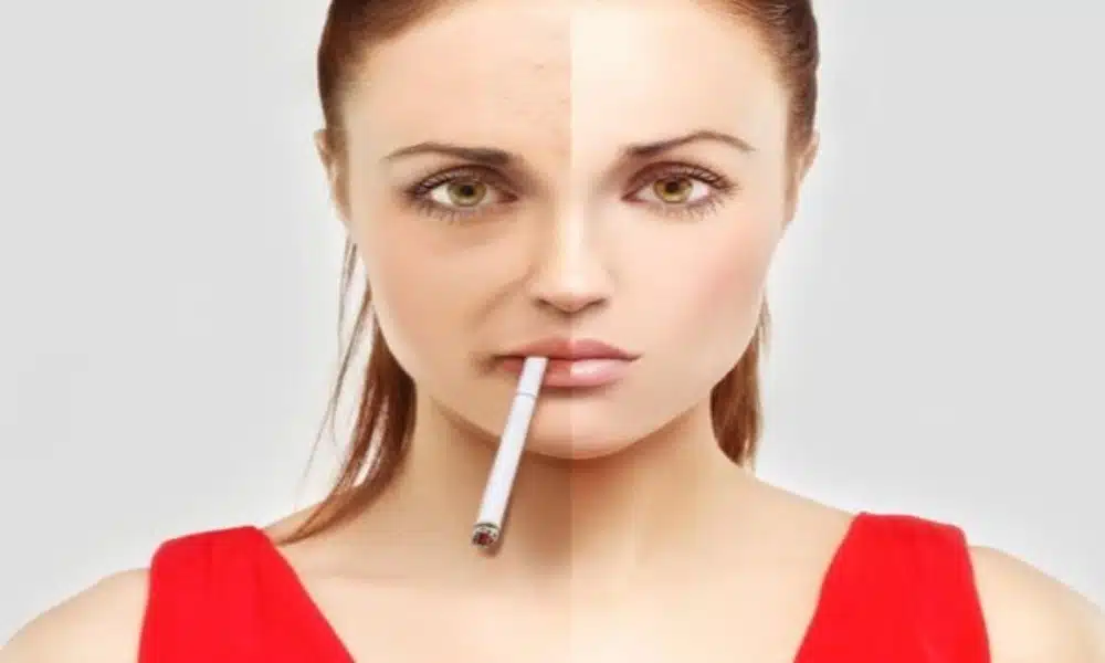 avoid after skin whitening injections